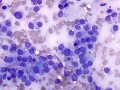 Soft tissue sarcoma (dog)