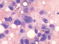 Osteosarcoma (dog)