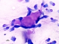 Suspect nerve sheath neoplasm (DQ, dog)