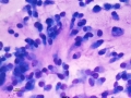 Suspect nerve sheath neoplasm (DQ, dog)