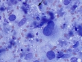 Sarcoma (cat)