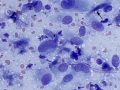 Sarcoma (cat)