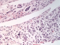 Soft tissue sarcoma (dog, H&E)