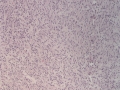 Soft tissue sarcoma (dog, H&E)