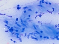 Smooth muscle