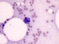 Mitotic figure (muscle)