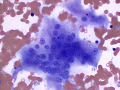 Osteoclast