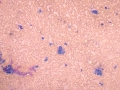 Sarcoma (cat)
