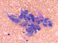 Sarcoma (cat)