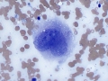 Histiocytic sarcoma (dog)