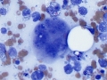 Histiocytic sarcoma (dog)