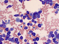 Mast cell tumor (cat)