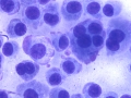 Extramedullary plasmacytoma (DQ, dog)