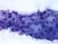 Sebaceous gland epithelium