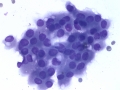 Apocrine gland epithelium