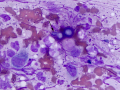 Blastomyces (mycelial form, DQ)