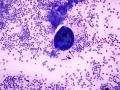 Protozoa & abscess (alpaca)
