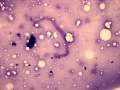 Collagen