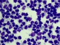 Corenybacterium abscess (horse)