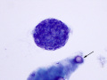 Emperipolesis in squames