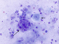 Emperipolesis in squames