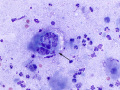 Emperipolesis in squames