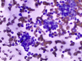 Blastomyces (DQ)