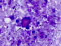 Suspect flame figure