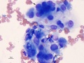 Soft tissue sarcoma (dog)