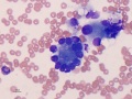 Soft tissue sarcoma (dog)