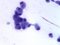Granular cell trichoblastoma (dog)