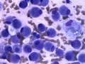 Granular cell trichoblastoma (dog)