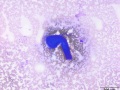 Hair follicle