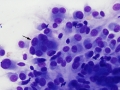 Soft tissue sarcoma (dog, DQ)