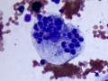 Leukophage