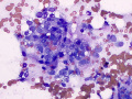 Suspect liposarcoma (dog)