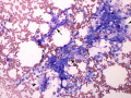 Suspect liposarcoma (dog)