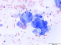 Carcinoma (cat)
