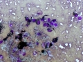 Melanoma (dog)