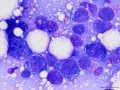 Squamous cell carcinoma (dog)