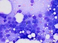 Squamous cell carcinoma (dog)
