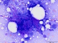 Squamous cell carcinoma (dog)