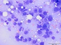 Squamous cell carcinoma (dog)