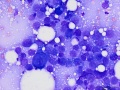 Squamous cell carcinoma (dog)