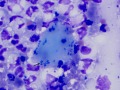 Micrococcus