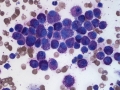 Mast cell tumor (dog)