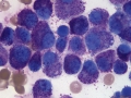 Mast cell tumor (dog)