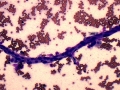 Blood vessel