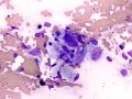 Giant cell tumor of soft parts (horse)
