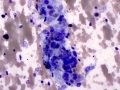 Giant cell tumor of soft parts (horse)